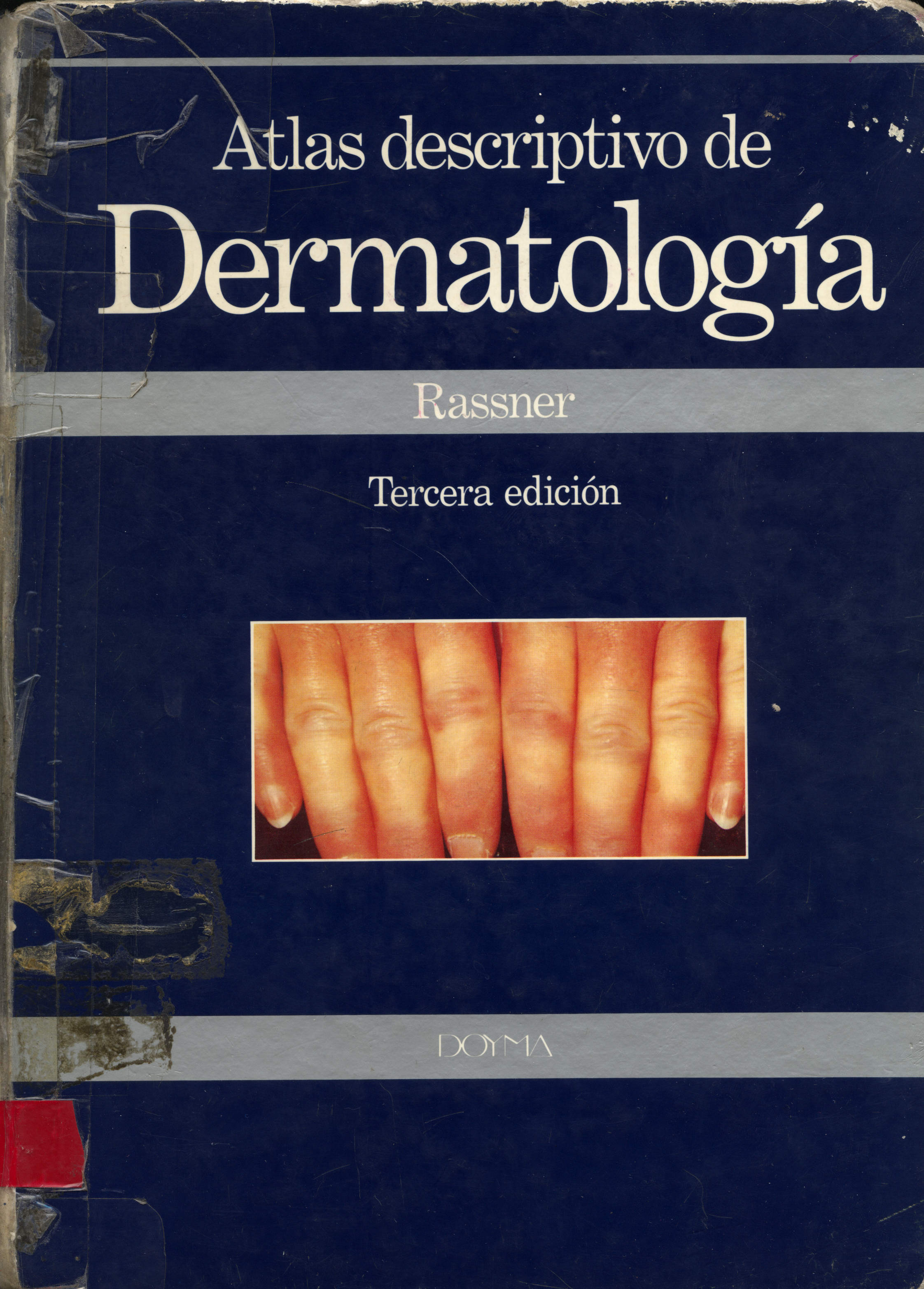 Atlas descriptivo de dermatología