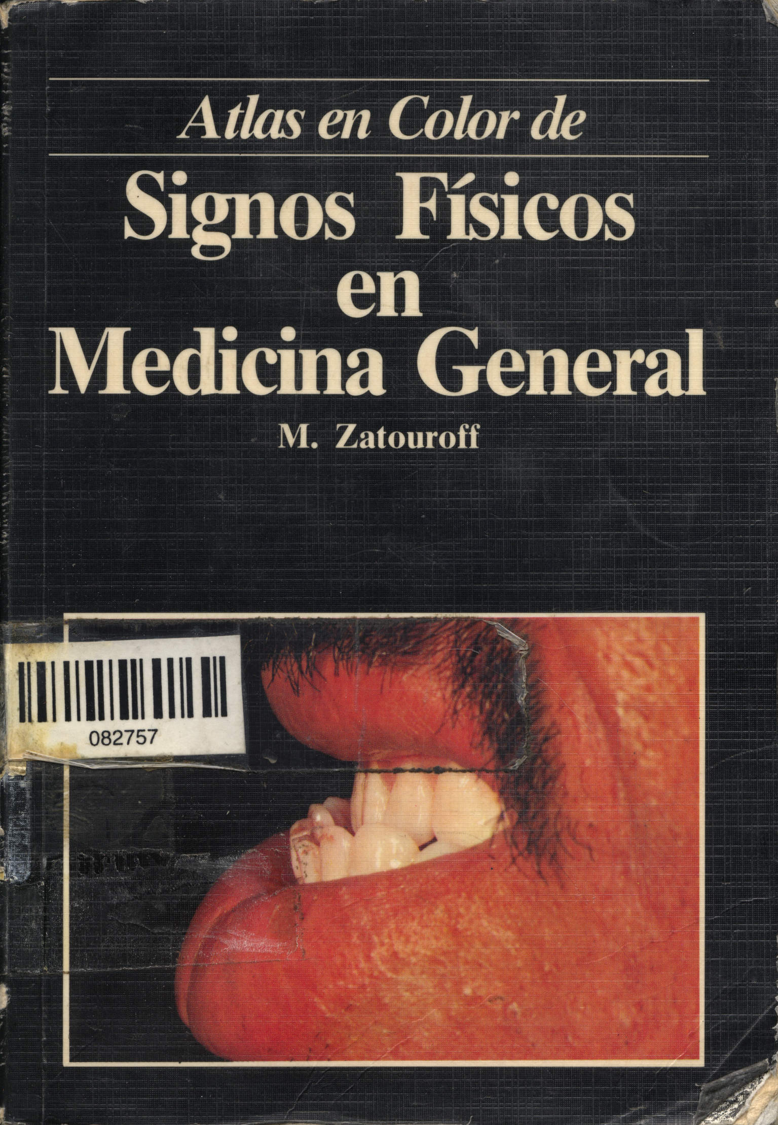 Atlas en color de signos fisicos en medicina general