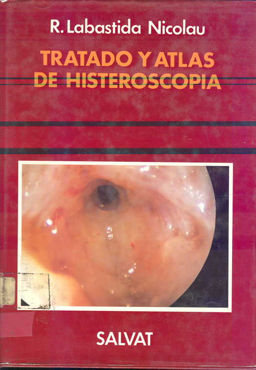 Tratado y Atlas de histeroscopia