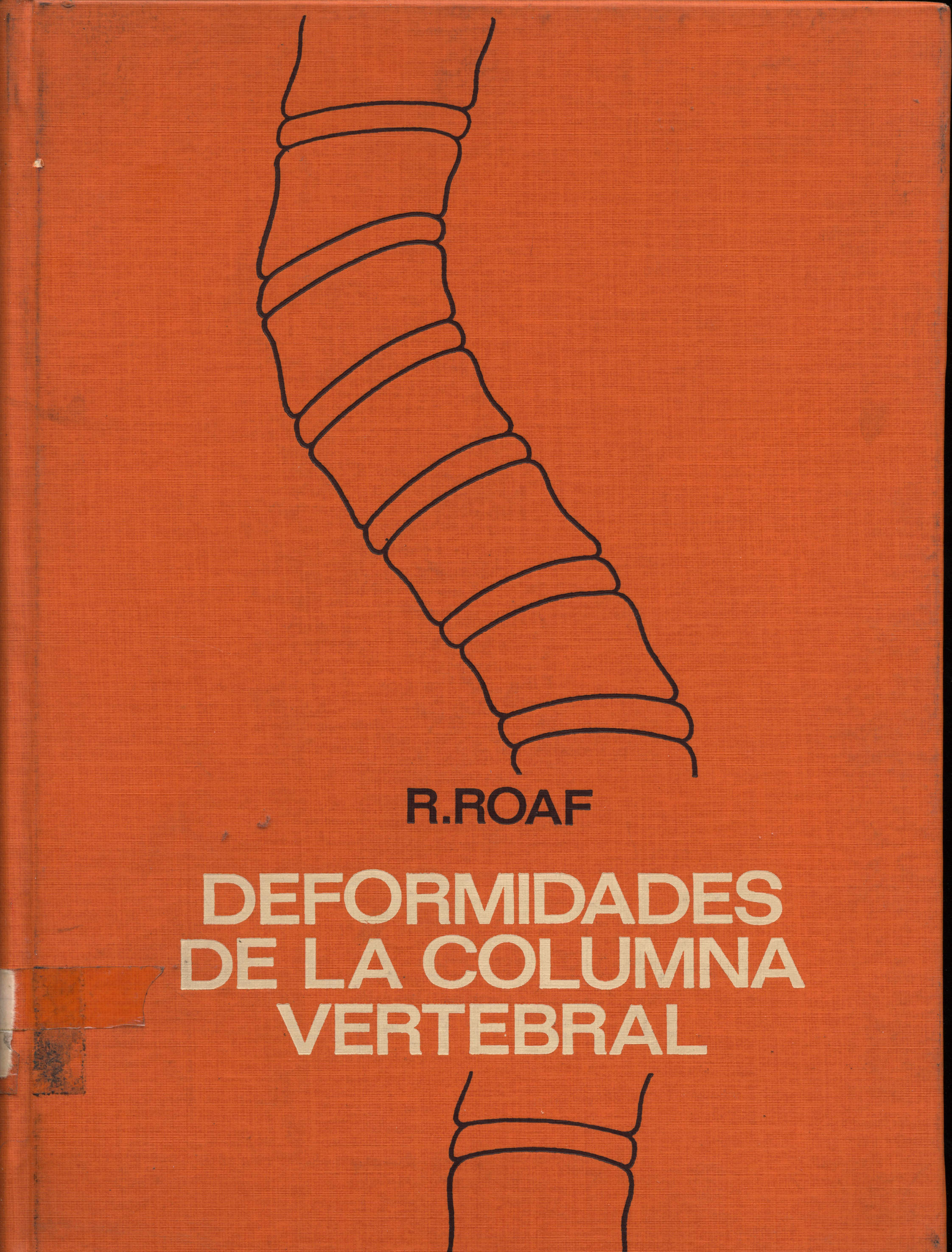 Deformidades de la columna vertebral