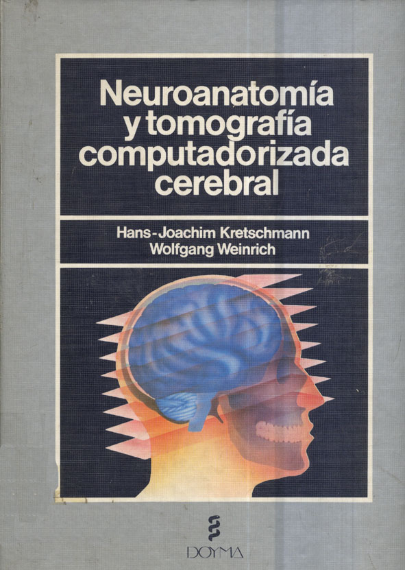 Neuroanatomia y tomografia computarizada cerebral