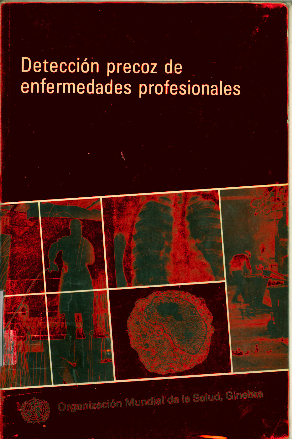 Deteccion precoz de Enfermedades Profesionales