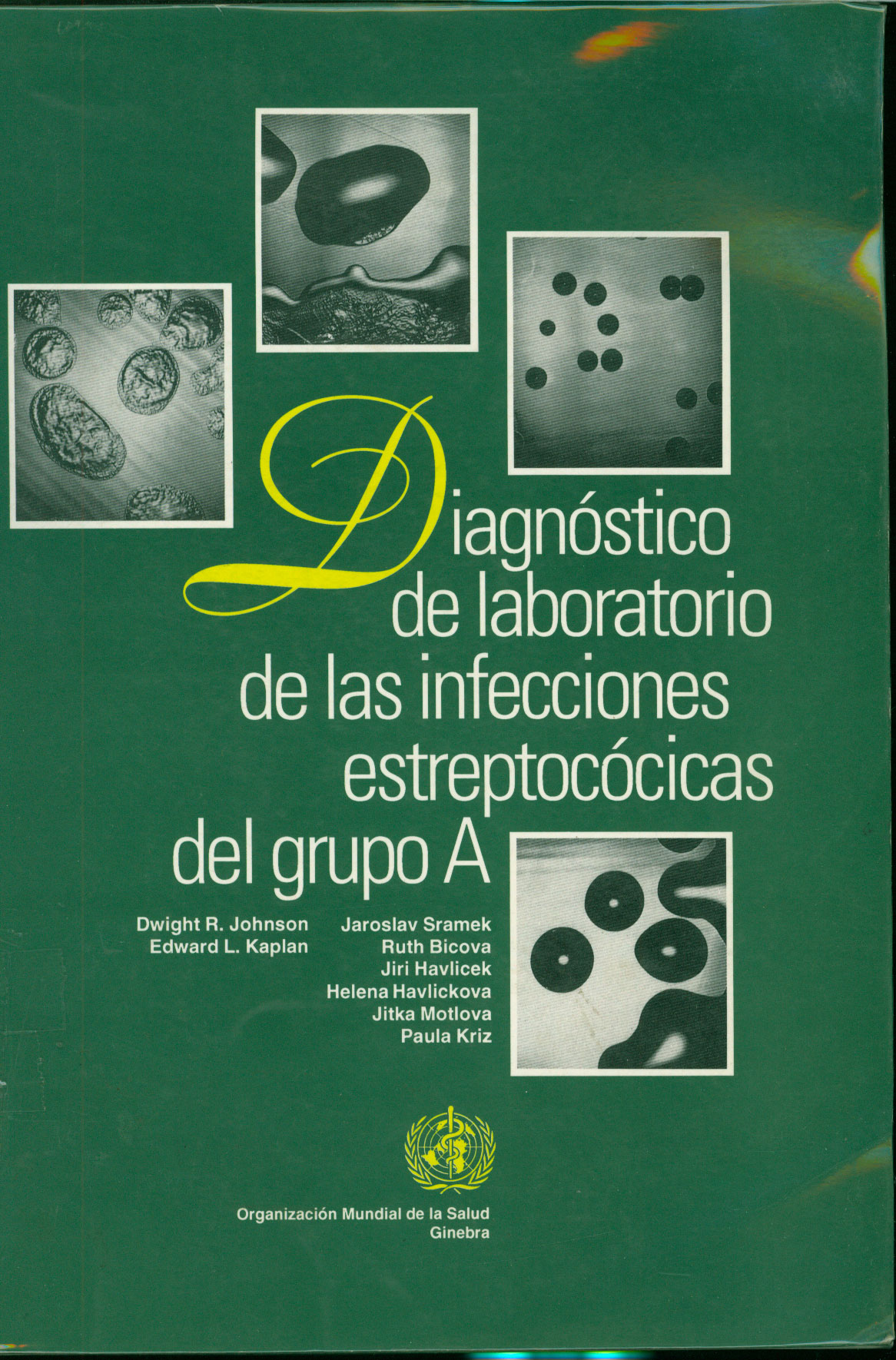 Diagnostico de laboratorio de las infecciones estreptococicas del grupo A
