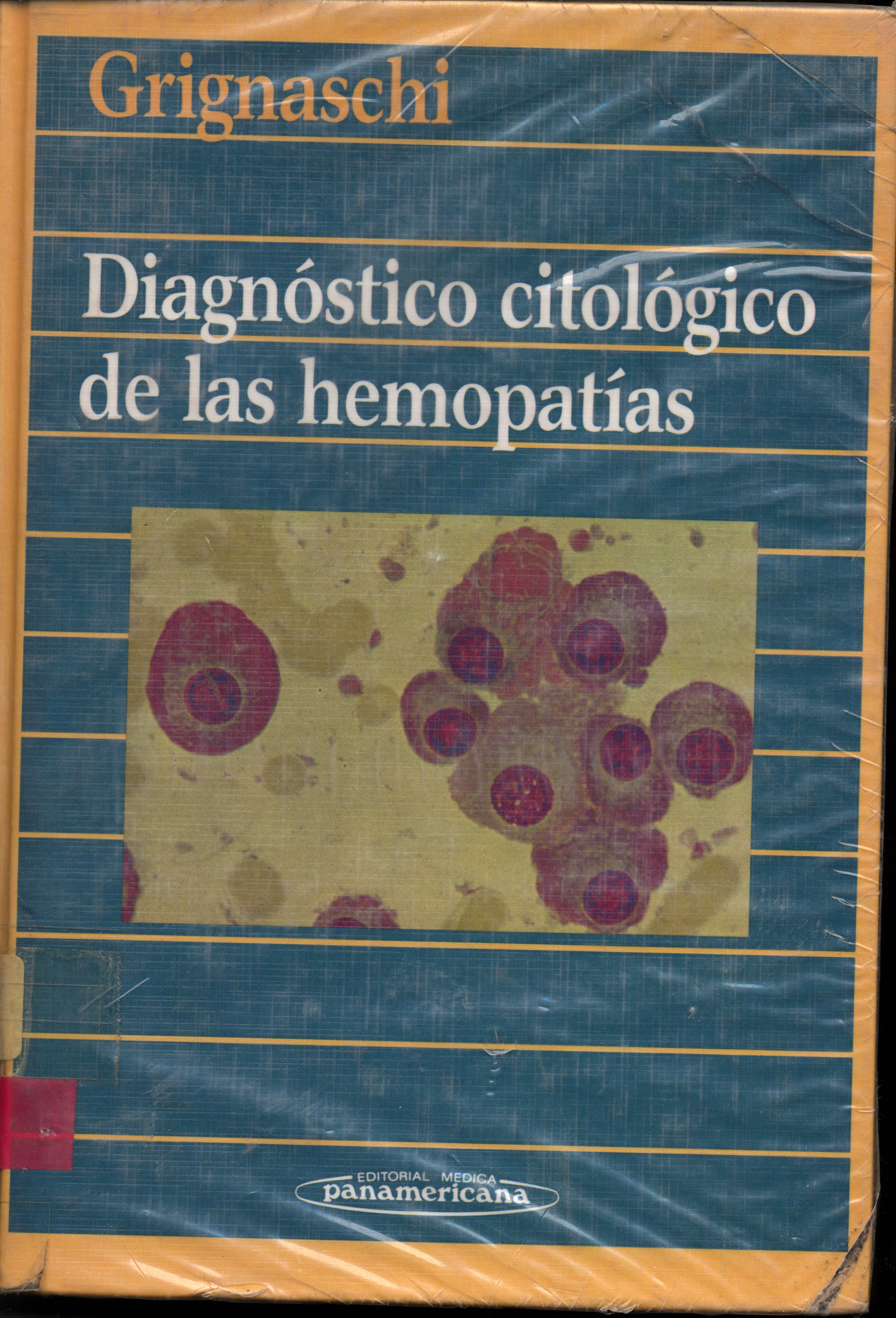 Diagnostico citologico de las hemopatias