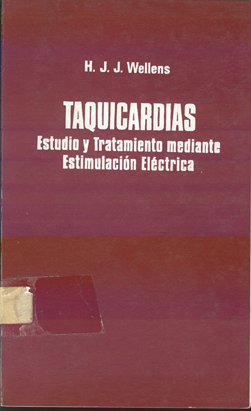 Taquicardias: Estudio y tratamiento mediante estimulación electrica
      <i>es</i>