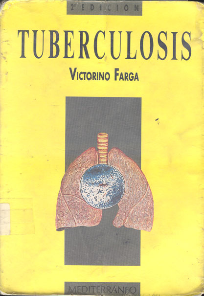Tuberculosis