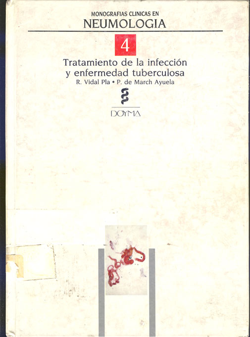 Tratamiento de la infección y enfermedad tubercolosa