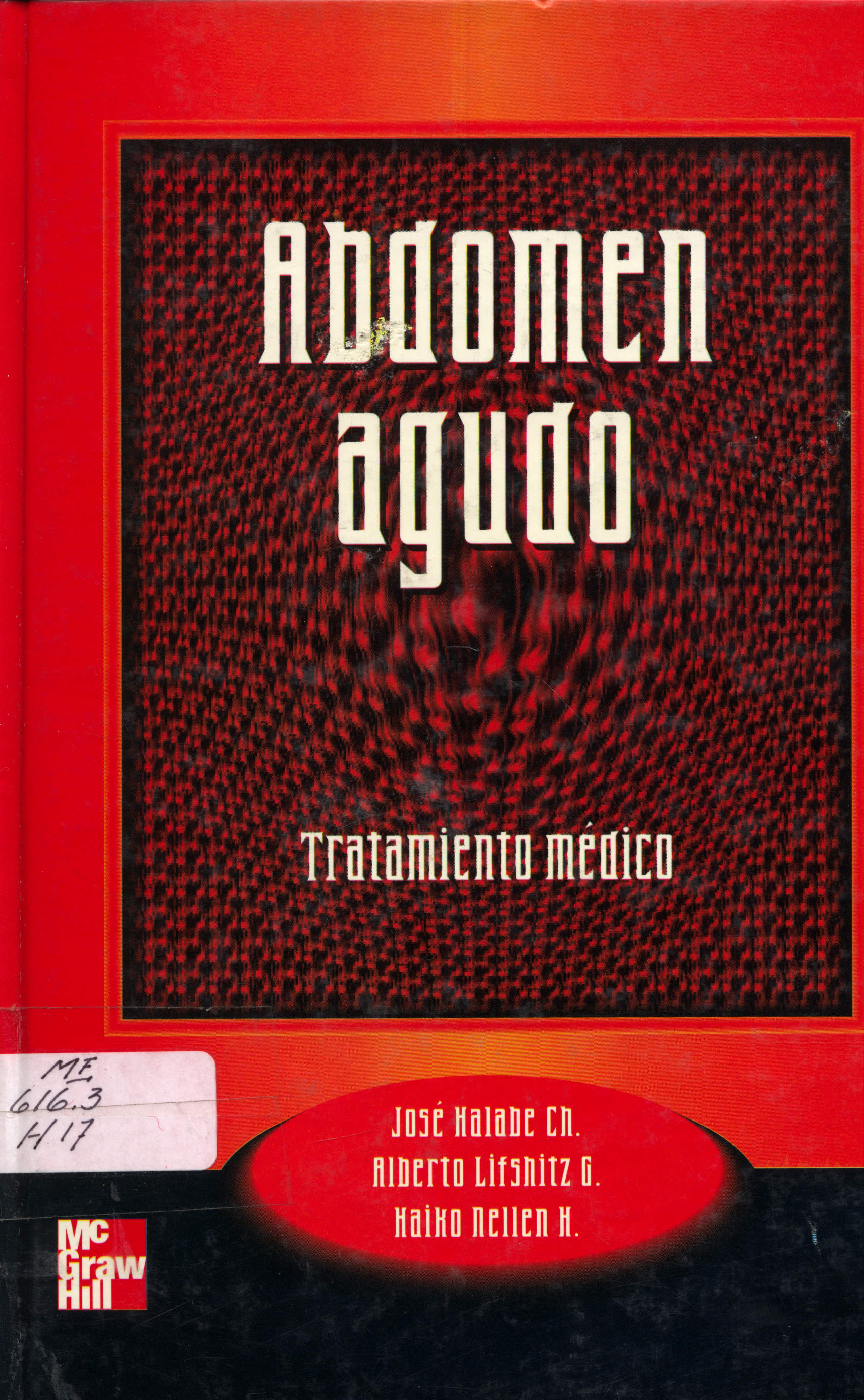 Abdomen agudo tratamiento medico