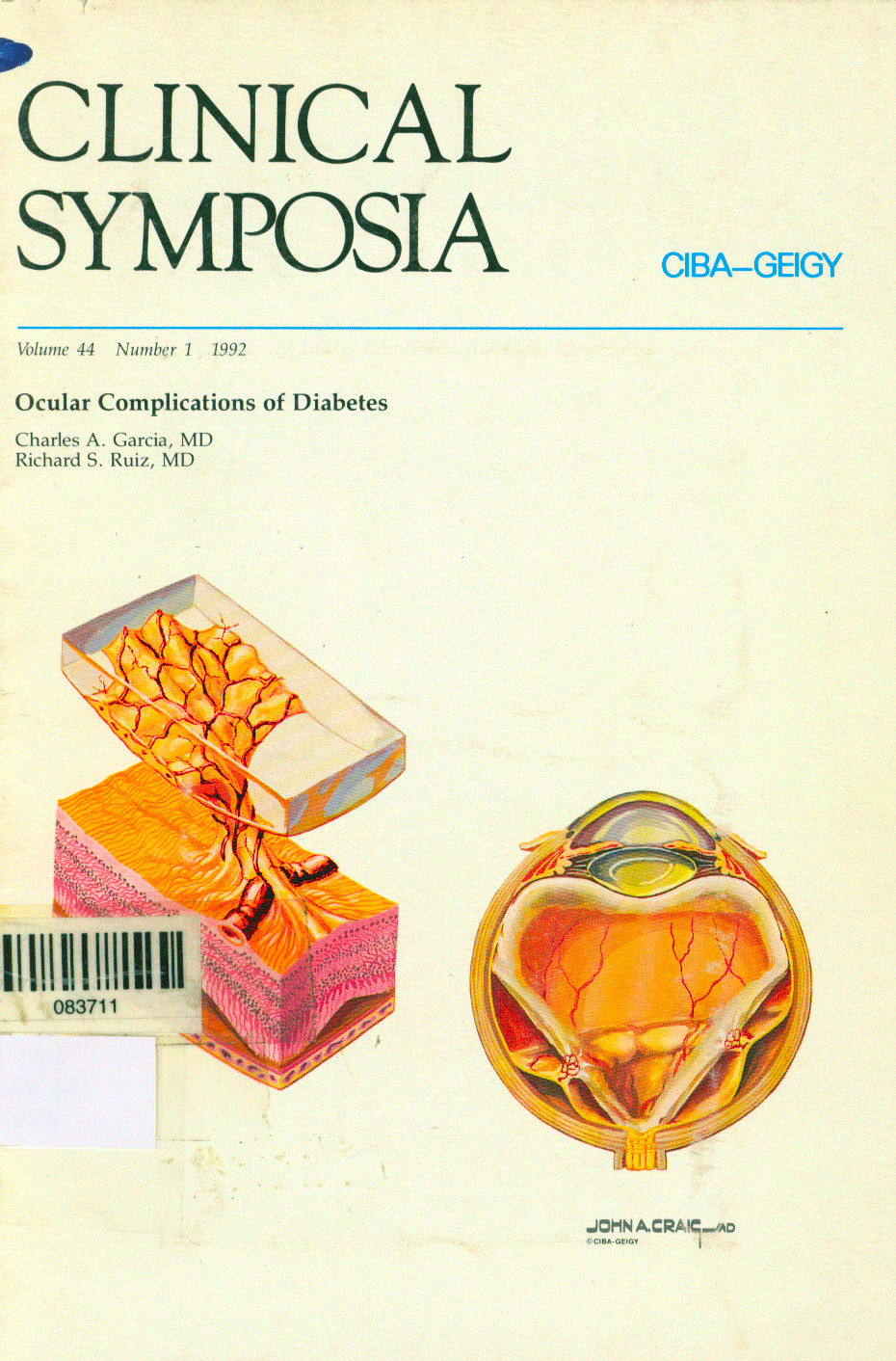 Ocular complications of diabetes:Clinical symposia
      <i>en</i>