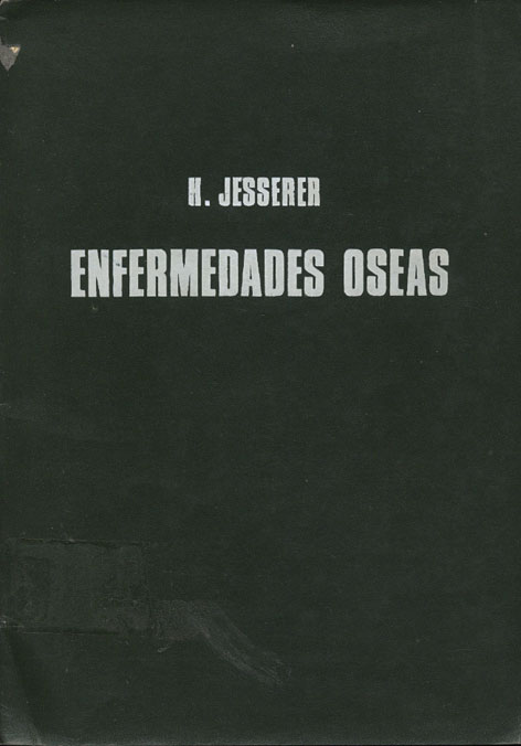 Enfermedades oseas