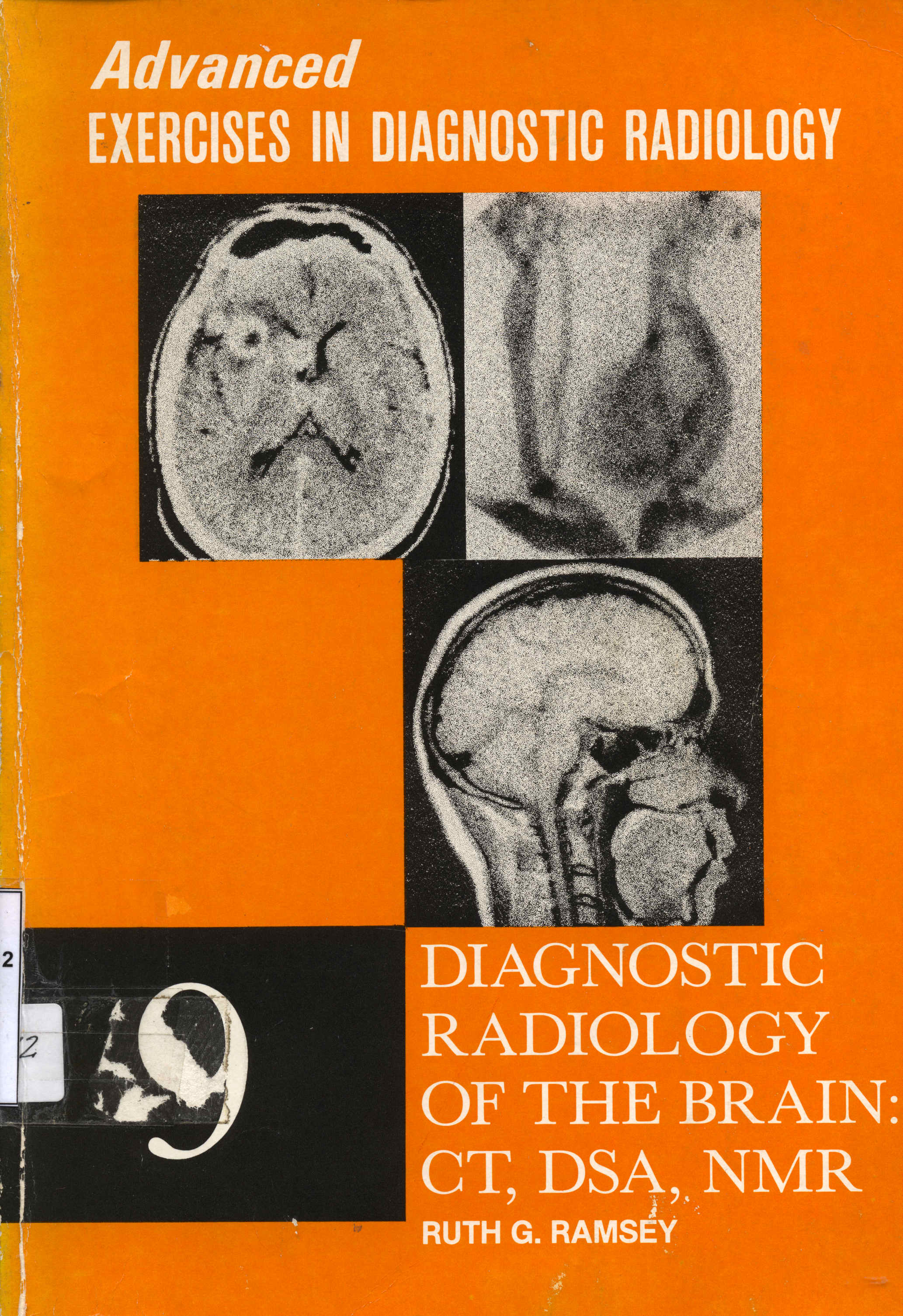 Advanced: Exercises in Diagnostic Radiology
      <i>en</i>