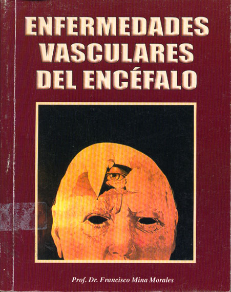 Enfermedades Vasculares del Encefalo