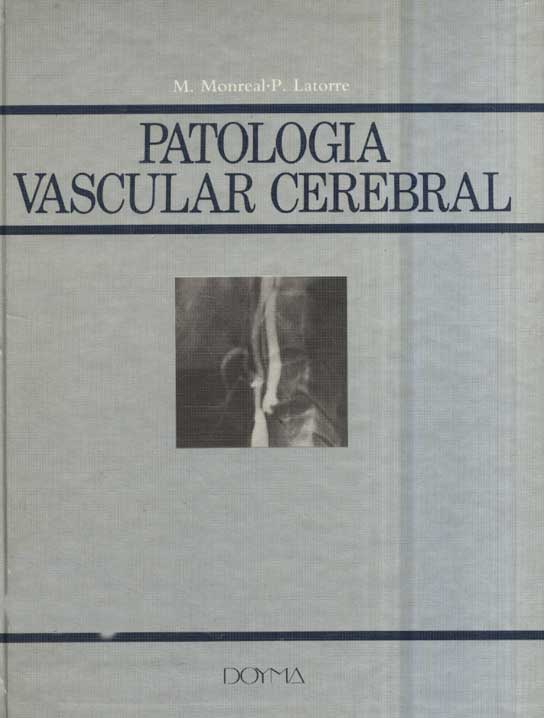Patologia Vascular Cerebral