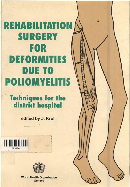 Rehabilitation surgery for deformities due to poliomyelitis