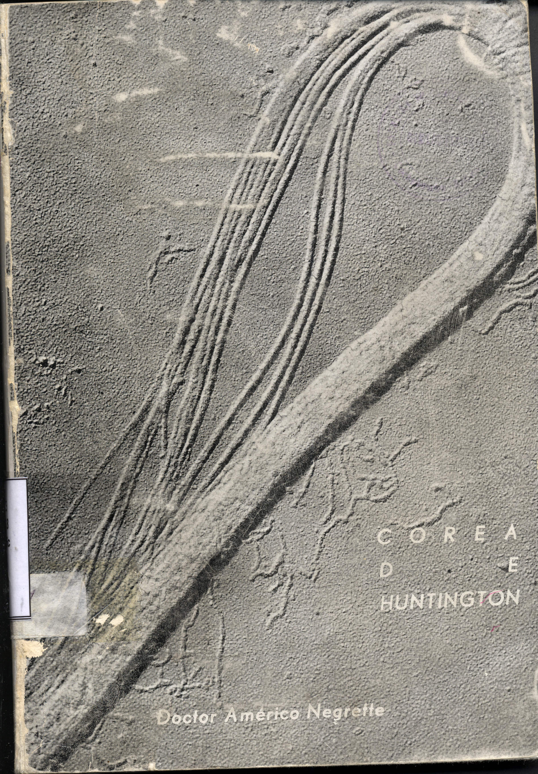 Corea de Huntington