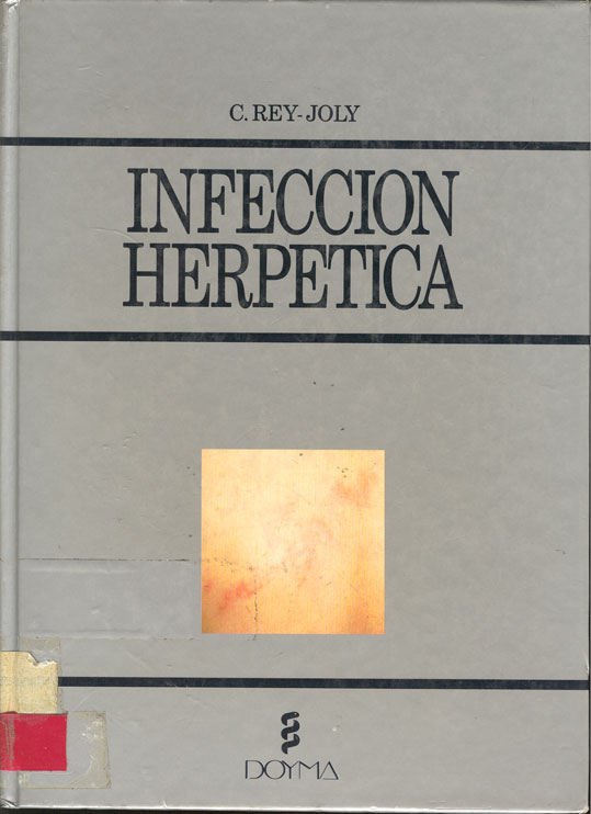 Infección Herpetica
