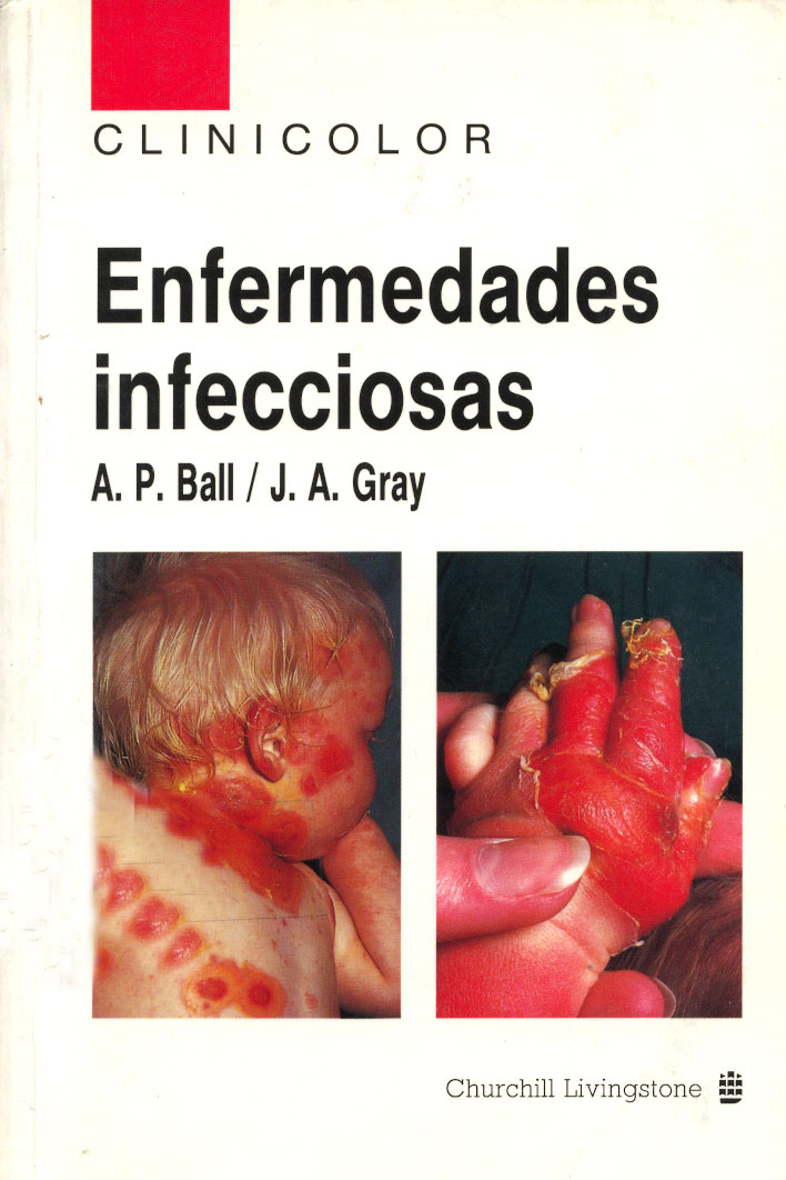 Enfermedades Infecciosas
