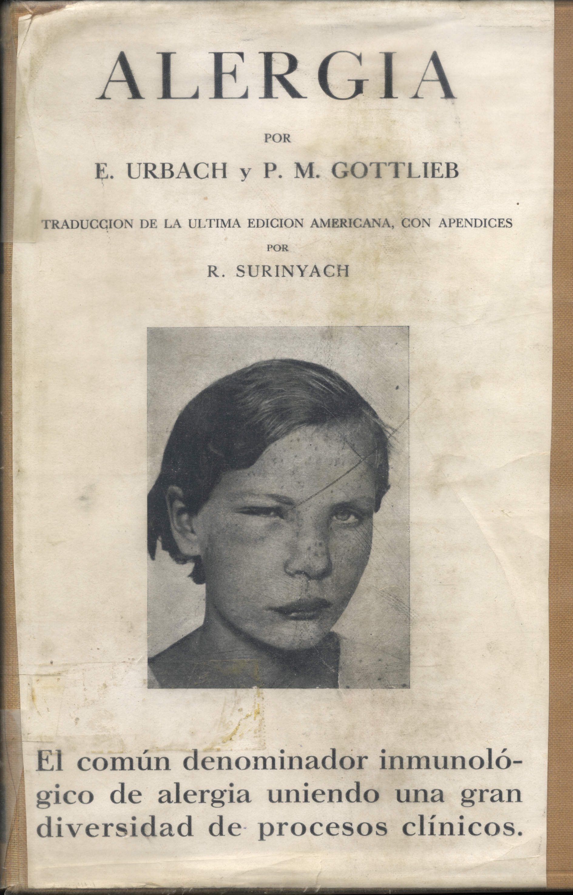 Alergia