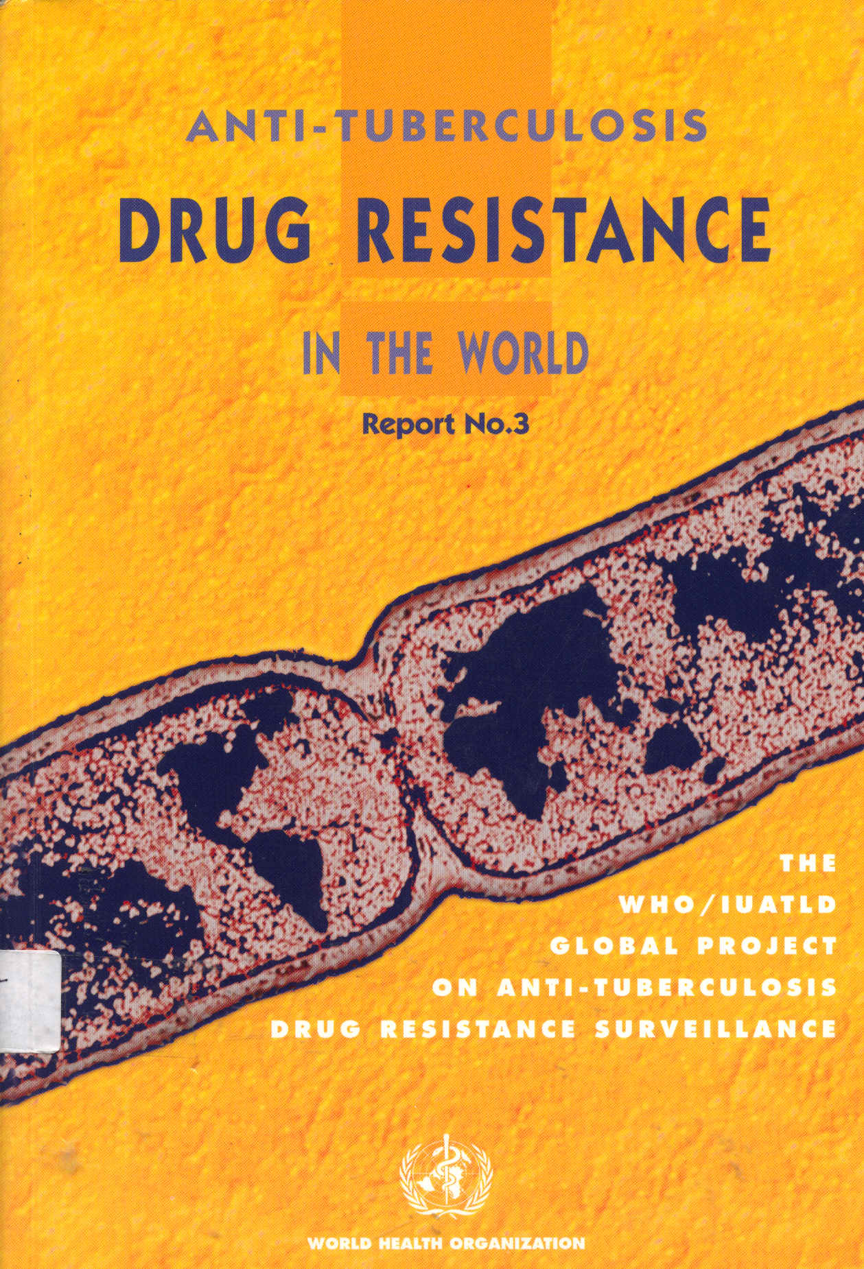 Anti - tuberculosis drug resistance in the world