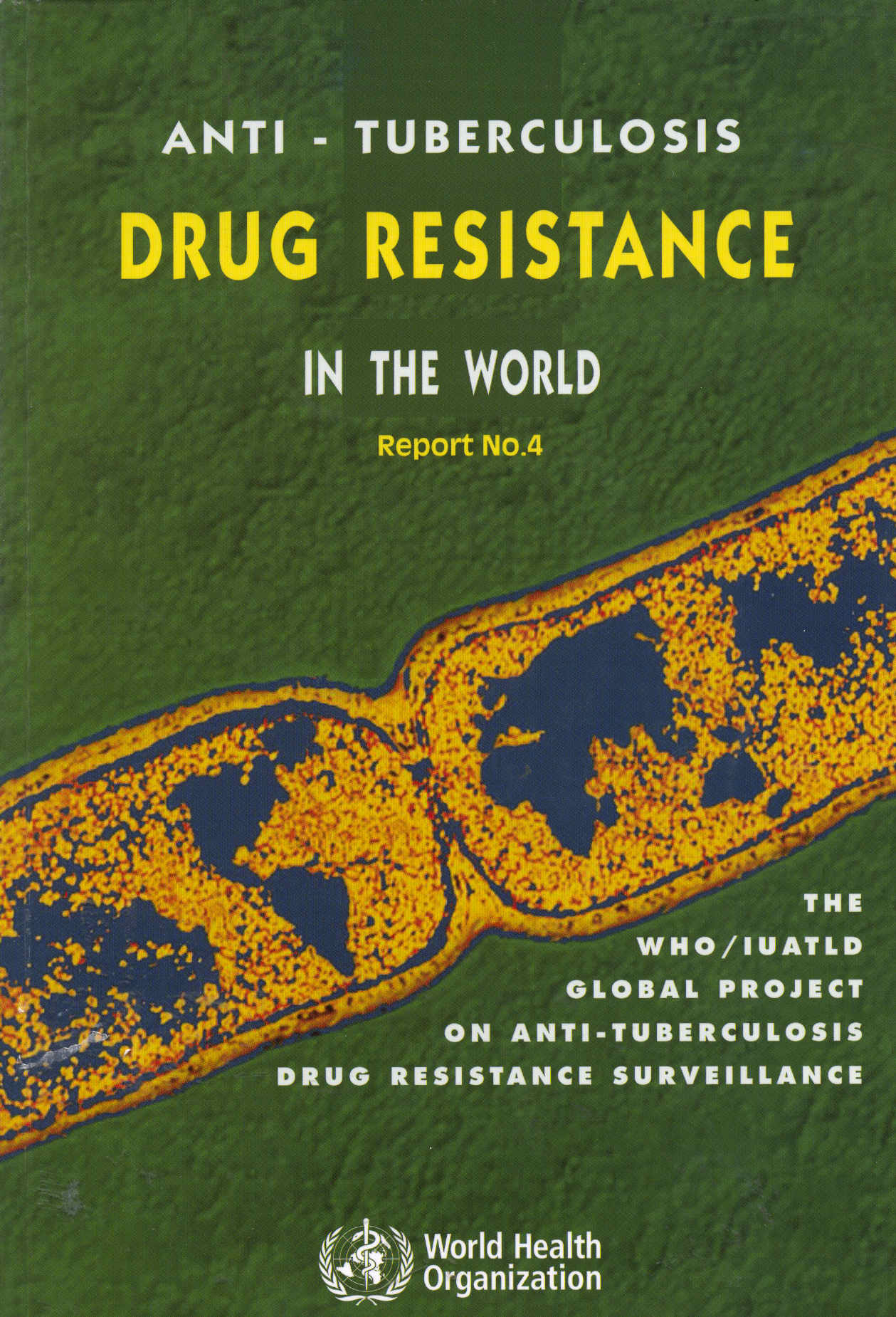 Anti - tuberculosis drug resistance in the world