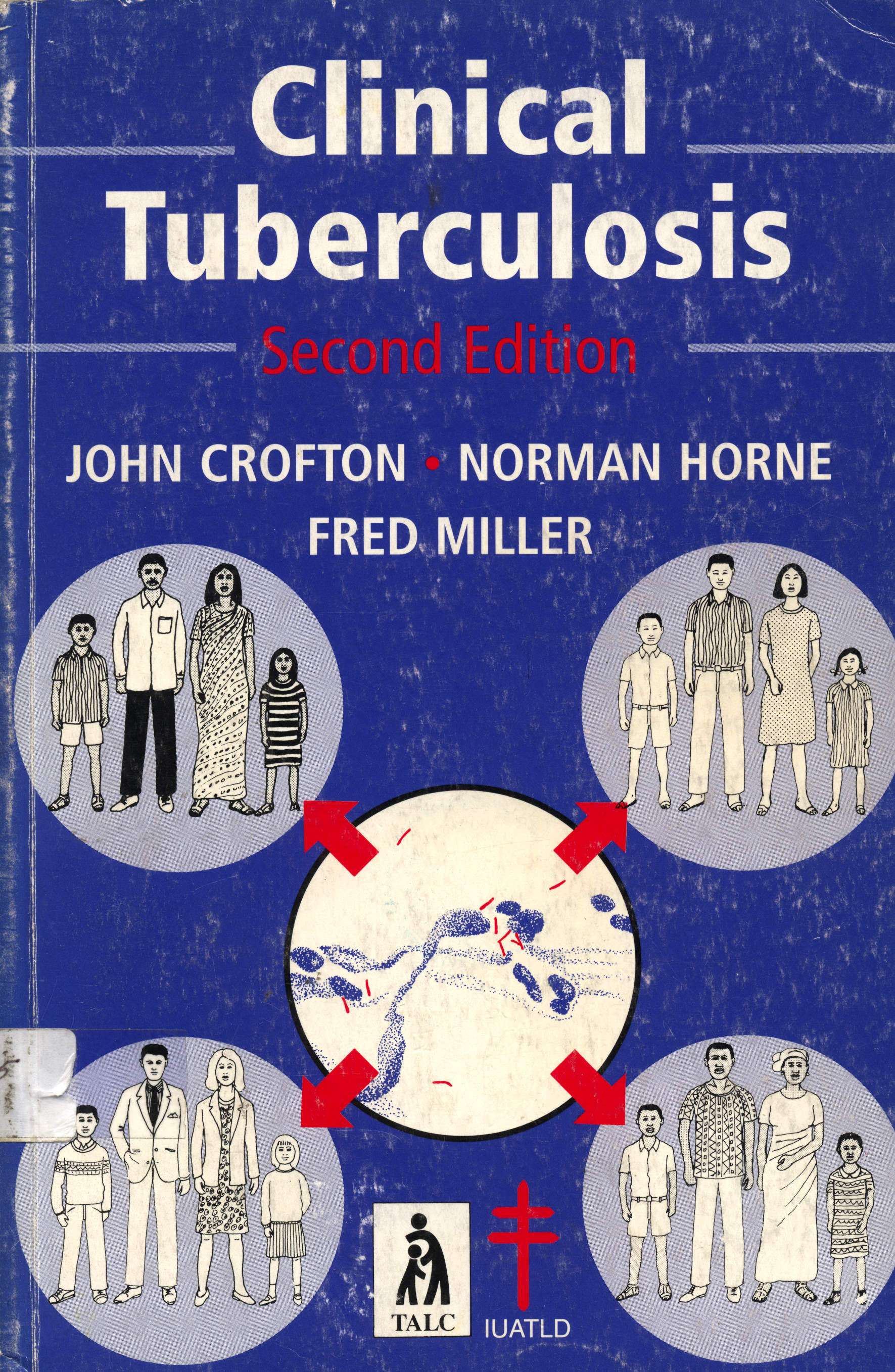 Clinical tuberculosis