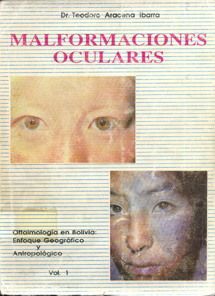 Malformaciones oculares
