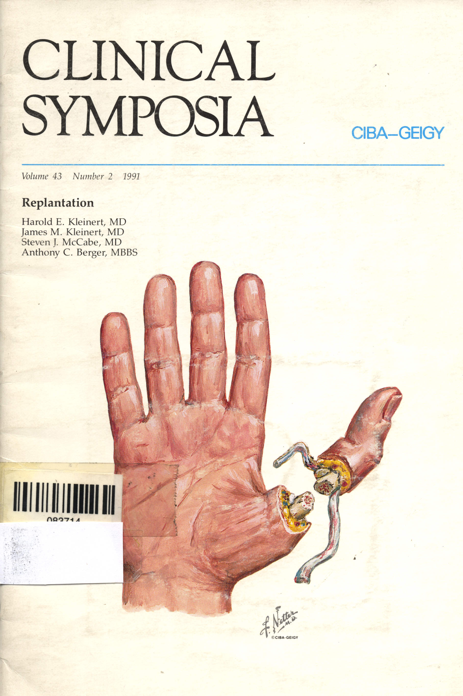 Clinical Symposia:Replantation