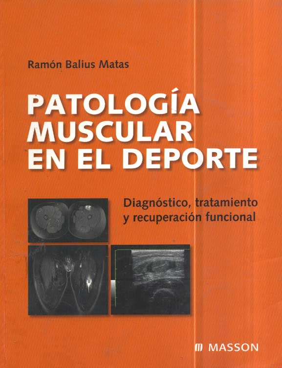 Patologia muscular en el deporte; Diagnostico, tratamiento y recuperacion funcional