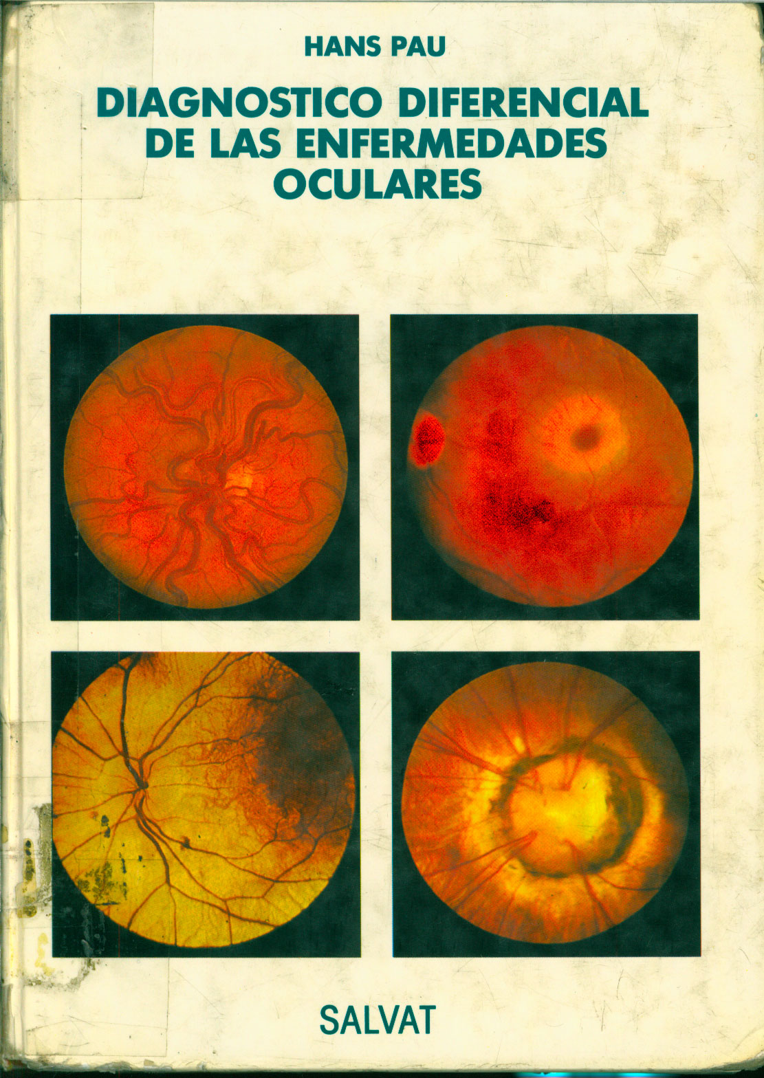 Diagnostico diferencial de las enfermedades oculares
