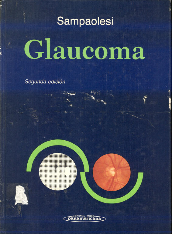 Glaucoma