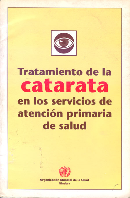 Tratamiento de la catarata en los servicios de atención primaria de salud