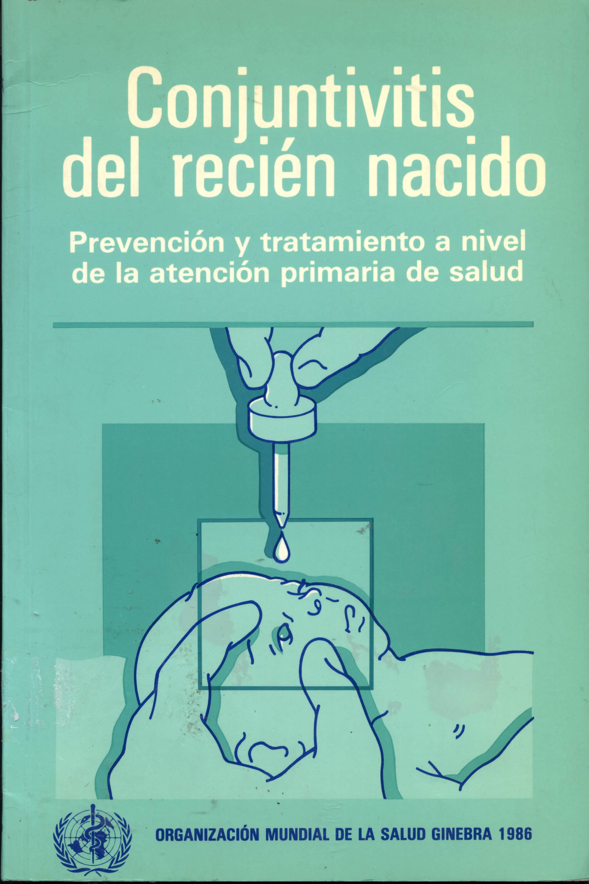Conjutivitis del recien nacido; prevencion y tratamiento a nivel de la atencion primaria de salud