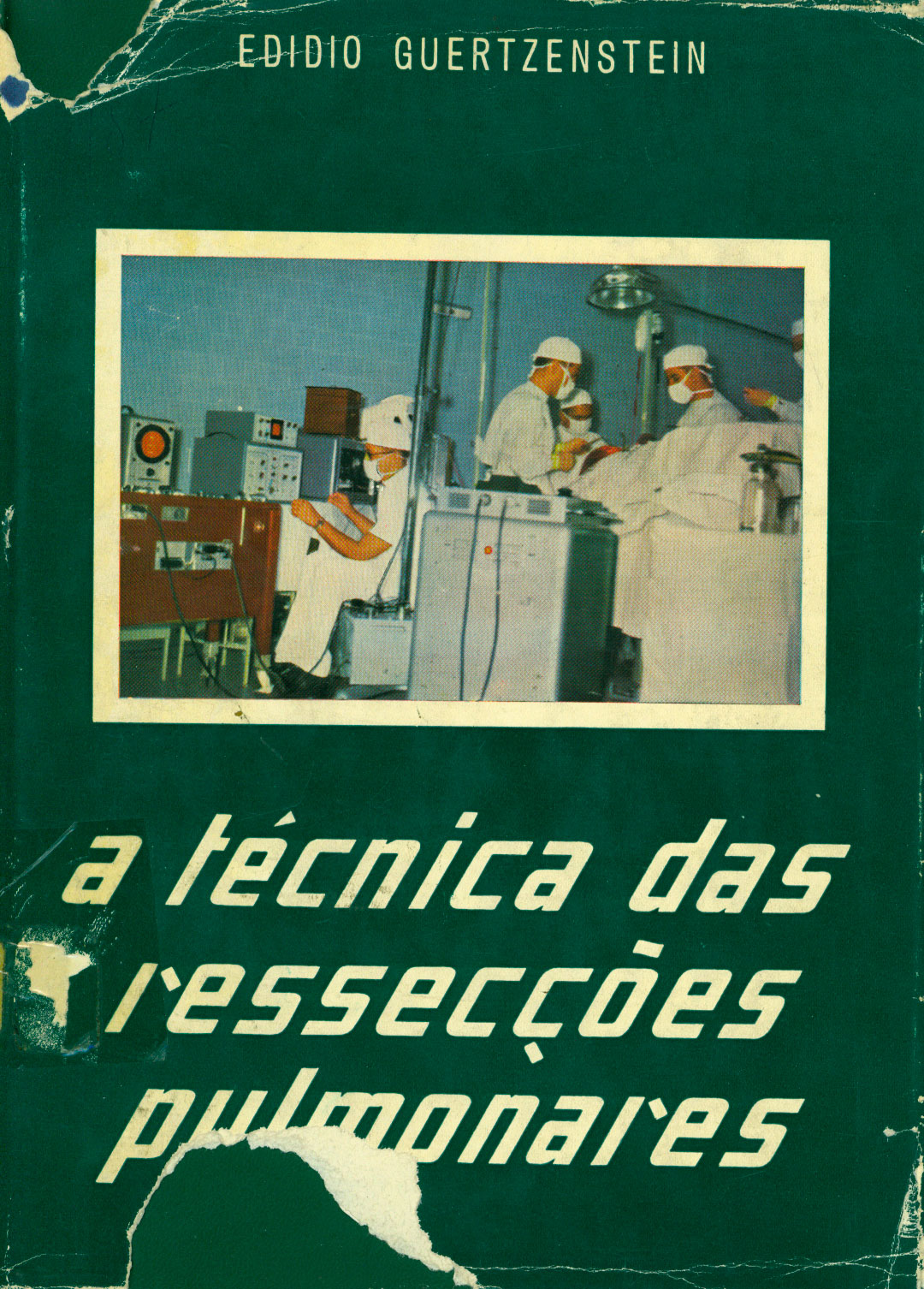 A tecnica das resseccoes pulmonares