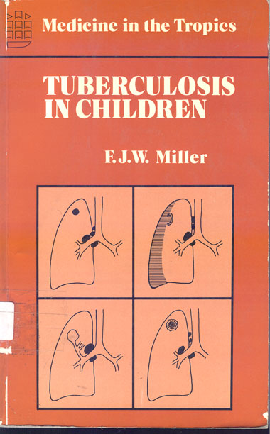 Tuberculosis in children