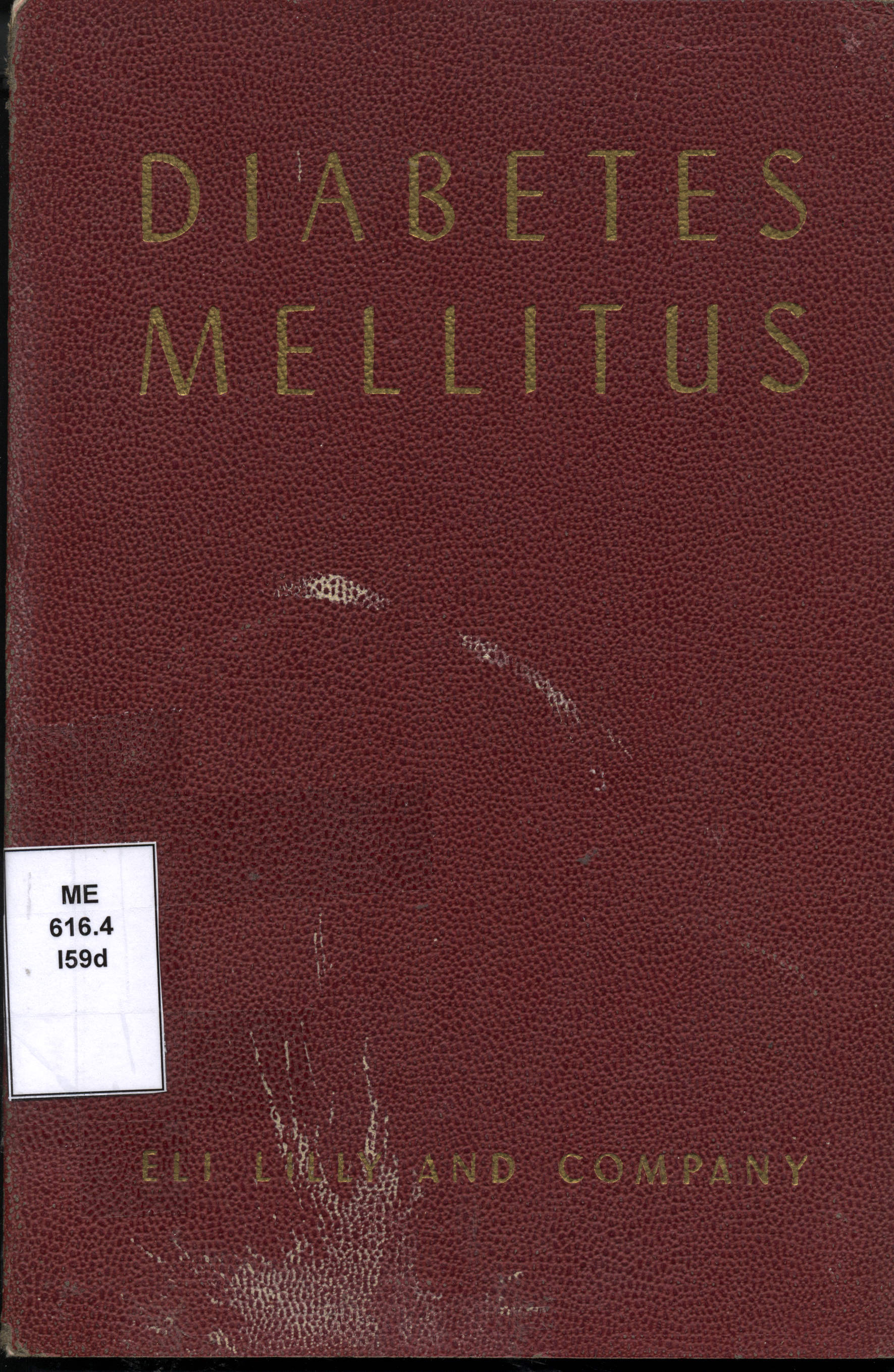 Diabetes mellitus