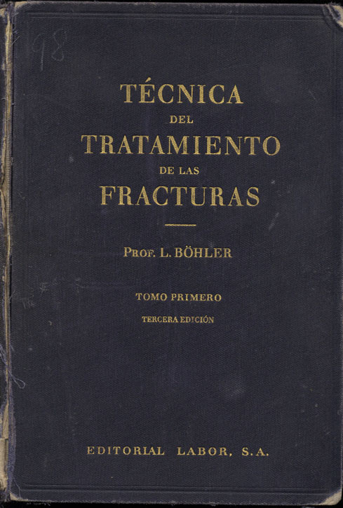 Tecnica del tratamiento de las fracturas
