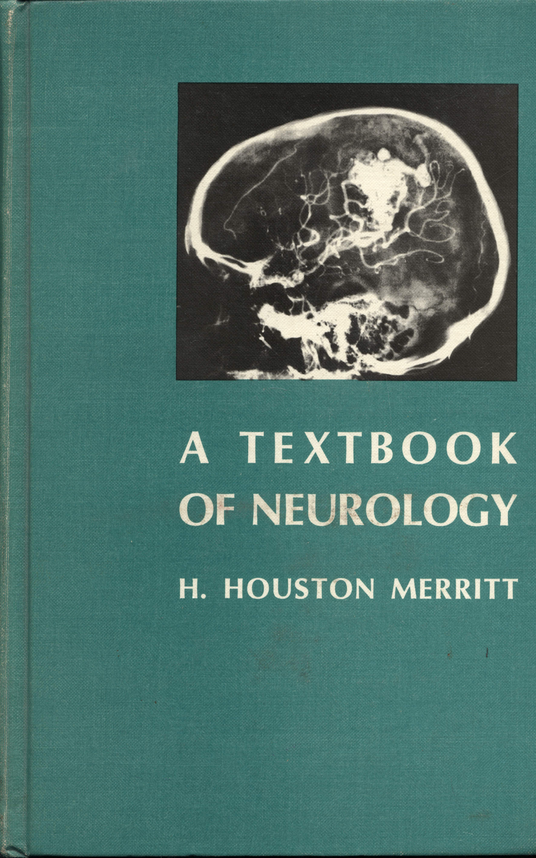 A textbook of neurology