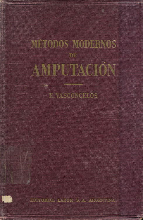 Métodos Modernos de Amputación