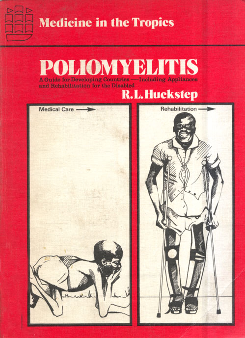 Poliomyelitis