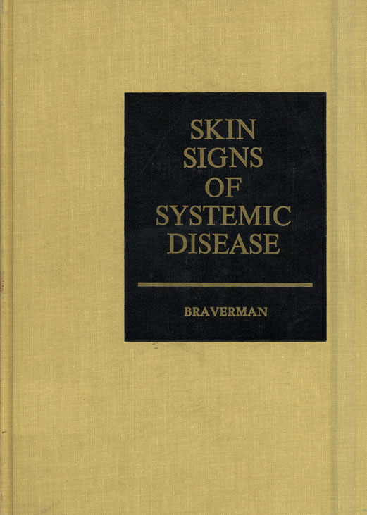 Skin signs of systemic disease