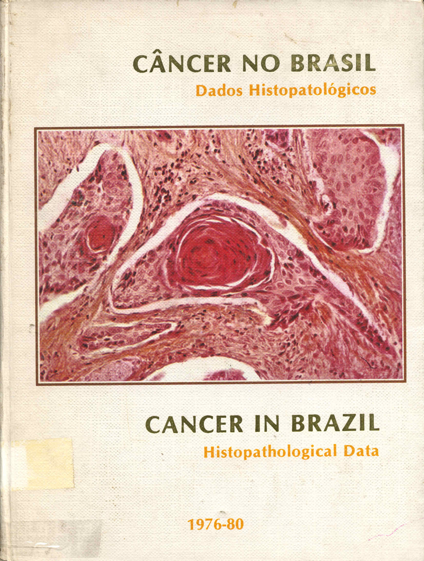 Cancer no Brasil Dados Histopatológicos