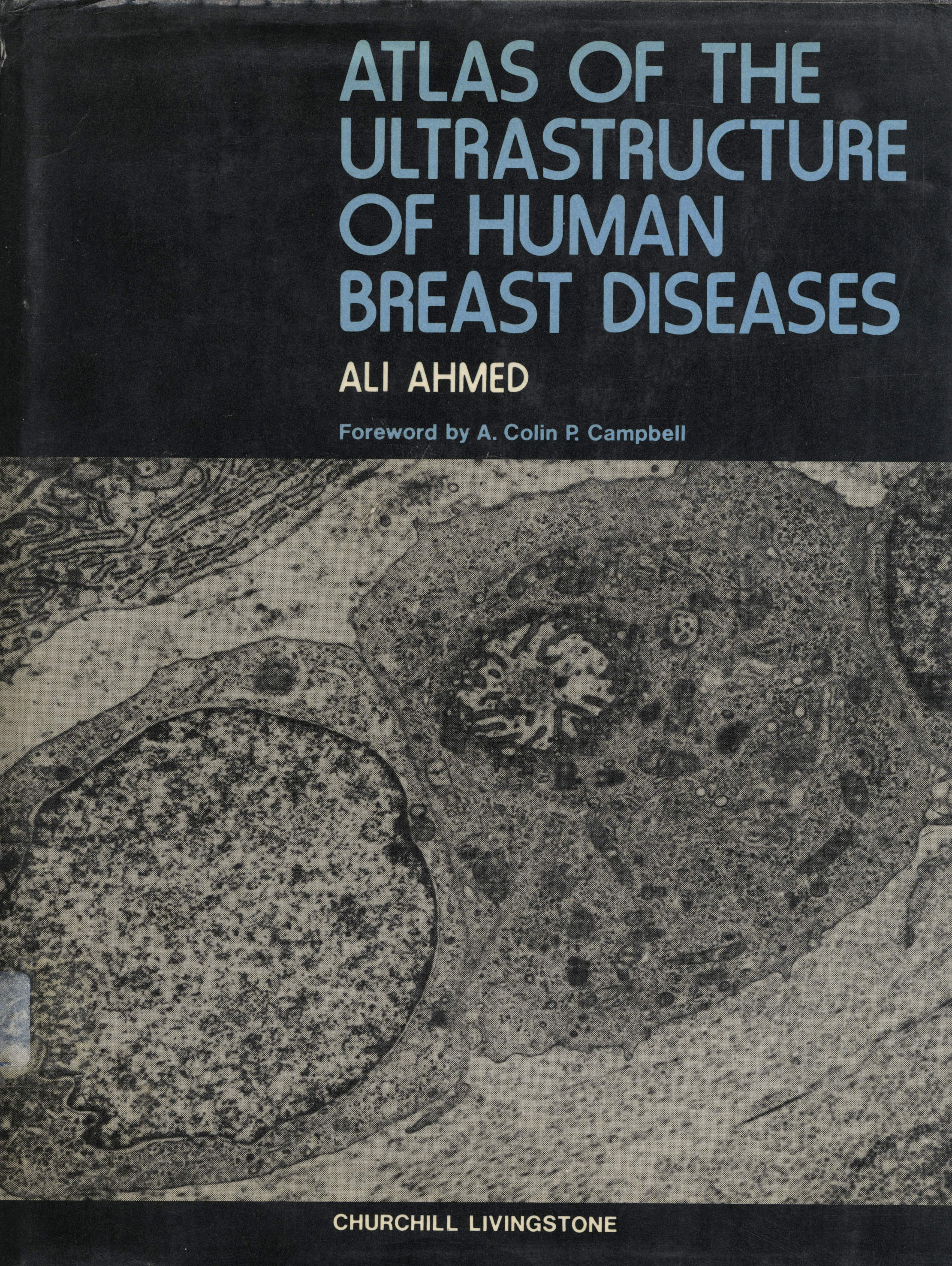Atlas of The Ultrastructure of Human Breast Diseases