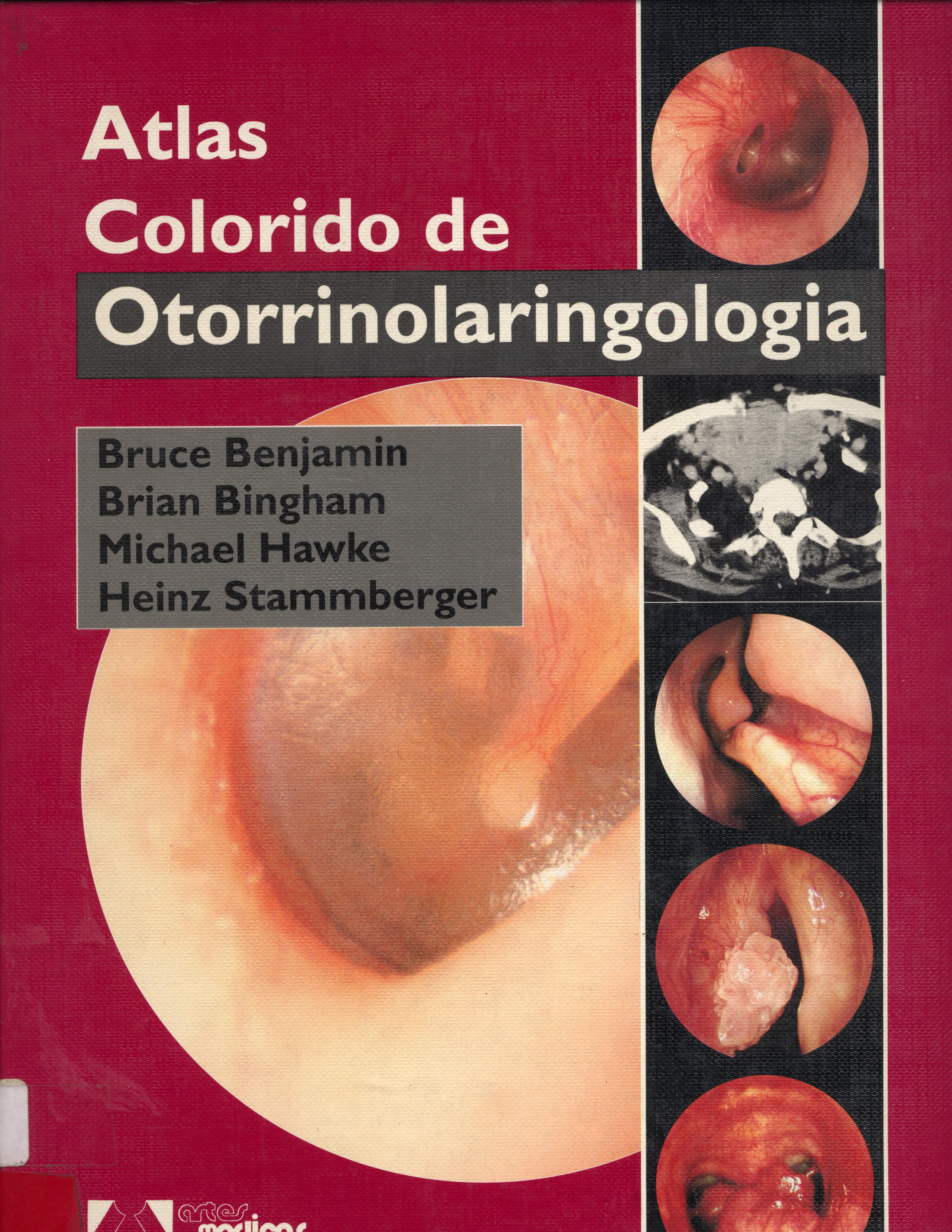 Atlas Colorido de Otorrinolaringologia