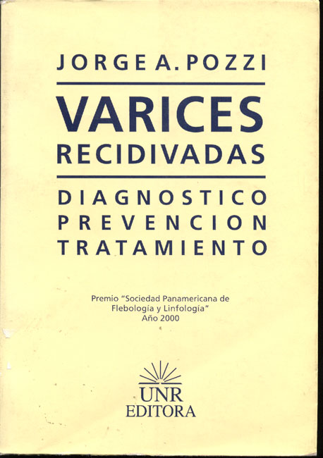 Varices Recidivadas - Diagnóstico prevención tratamiento
