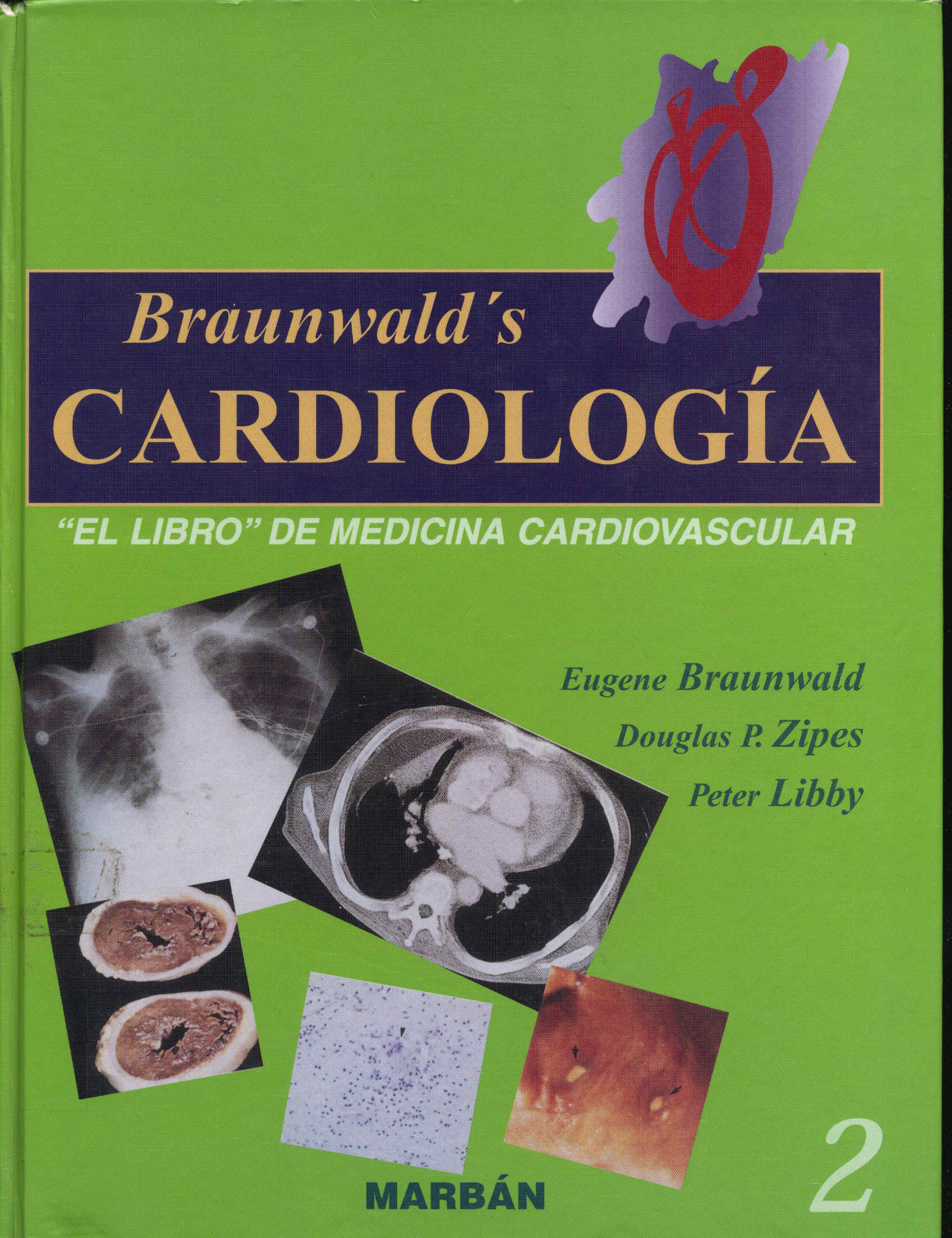 Braunwald's Cardiologia