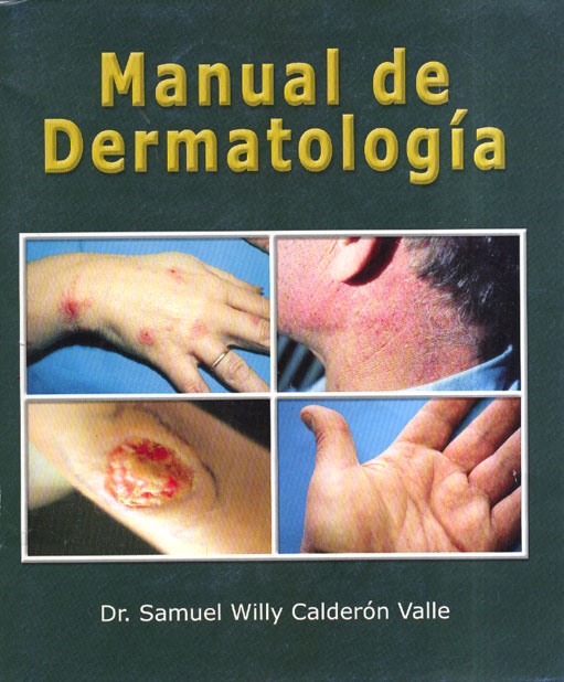 Manual de Dermatologia