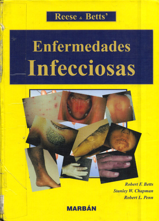 Enfermedades infecciosas