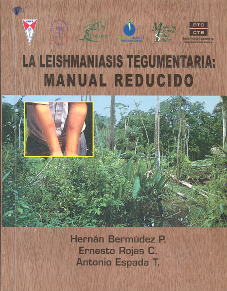 La leishmaniasis tegumenteria: manual reducido