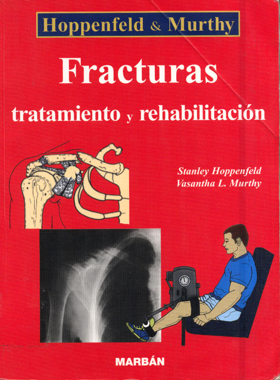 Fracturas tratamiento y rehabilitación