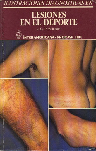 Lesiones en el deporte
